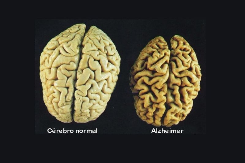 A Incapacidade Cognitiva