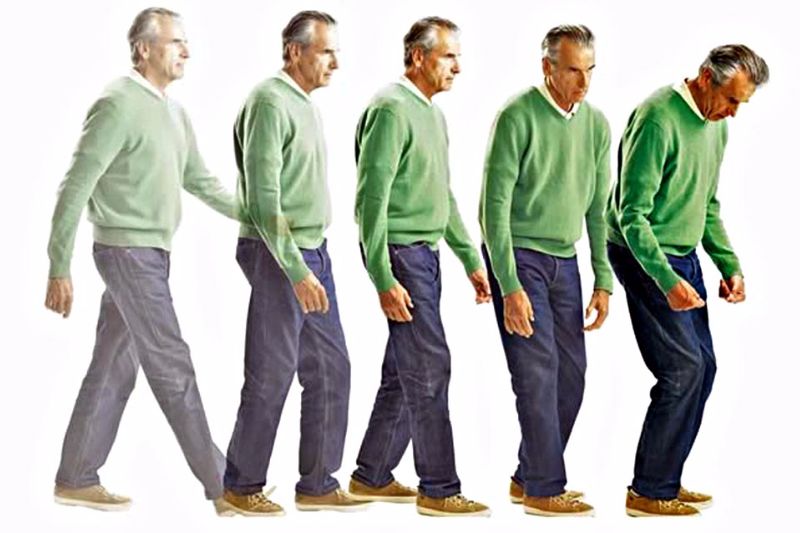 Sobre a Doença de Parkinson